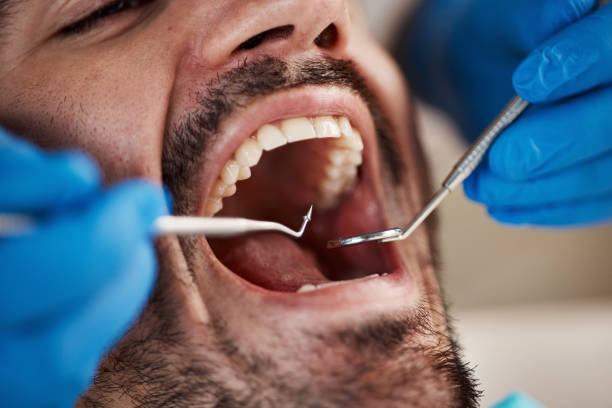 Best Emergency Care for Gum Disease in South Amherst, OH