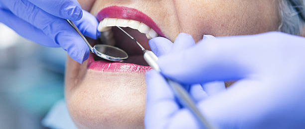 Best Emergency Wisdom Tooth Extraction in South Amherst, OH